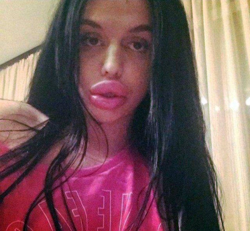 Big lips white girl