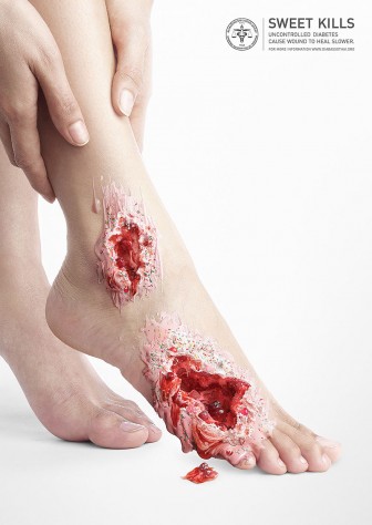 Terrifying photos of the sugar warning.
