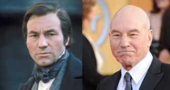 Celebrity photos before and after they lost their hair -- bald celebrities.