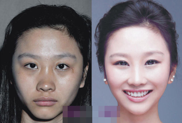 صور عجائب عمليات التجميل في الصين