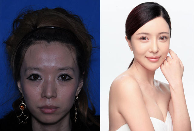 صور عجائب عمليات التجميل في الصين