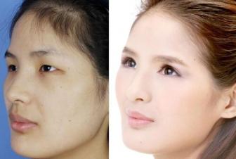 صور عجائب عمليات التجميل في الصين